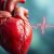 Bradykardia