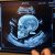 Radiologiczne objawy śmierci płodu
