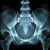 Radioanatomia miednicy